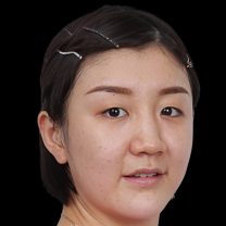  2026体育圈新趋势：伤病管理与心态修复的机会点 情感心理